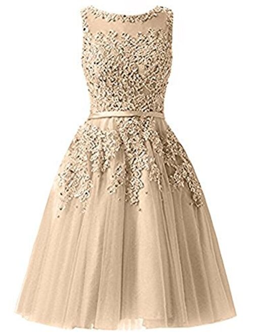 Ever Girl Women's Knee Length Tulle Lace Appliques Hollow Homecoming Dress