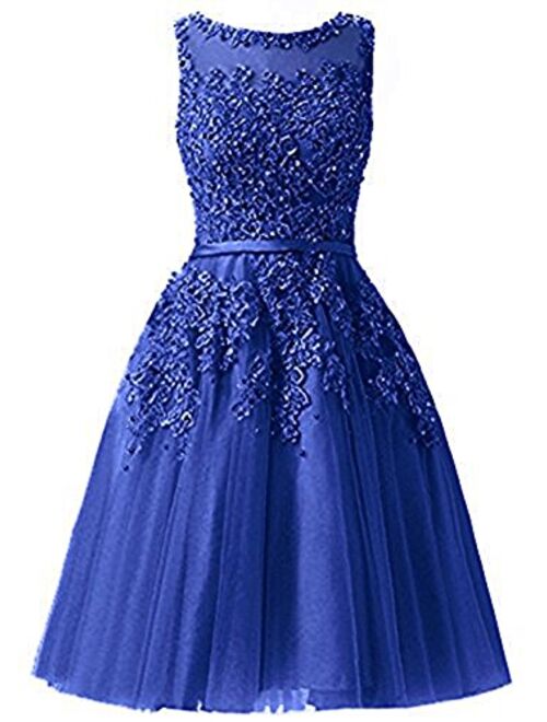 Ever Girl Women's Knee Length Tulle Lace Appliques Hollow Homecoming Dress